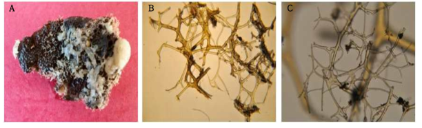 Scalarispongia radicula n. sp. A, Entire animal; B, Surface skeletal structure; C, Pseudo-tertiary fibres at the base