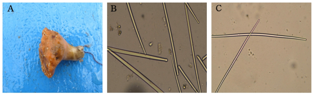 Weberella n. sp. A, Entire animal; B, C, Tylostyles spicules
