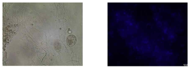 혐기성 균류 (학명) JS2의 형태 모습