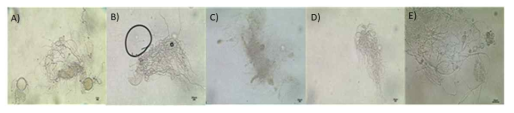 발굴된 미기록종의 배양학적 특징(혐기성 균주) A) Neocallimastix sp. JS11, B) Neocallimastix frontalis JS15, C) Pecoramyces ruminantium JS17, D) Neocallimastix sp. JS26, E) Neocallimastix sp. JS88