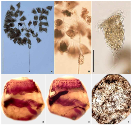 Campanella umbellaria in vivo (A–C), after protargol (D, E) and silver nitrate impregnation (F). Scale bars = 1000 μm (A), 100 μm (C)