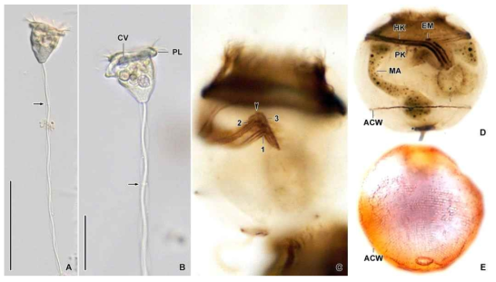 Pseudovorticella difficilis in vivo (A, B), after protargol (C, D) and silver nitrate impregnation (E). Scale bars = 100 μm (A), 50 μm (B)