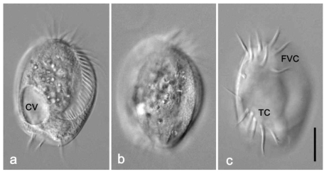 Micrographs of Euplotes encysticus in vivo. (a) dorsal views showing contractile vacuole (CC) and adoral membranelles, (b) dorsal ridges, (c) ventral side showing FVC (frontoventral cirri) and TC (transvers cirri). All images are DIC images. Scale bar=20 μm