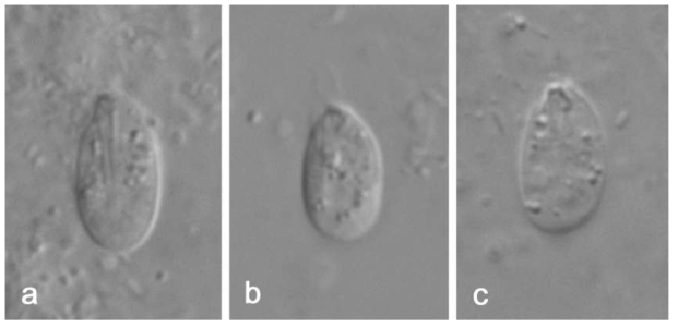 Ploeotia obliqua. (a) and (c) ventral view showing ingestion organelle, (b) dorsal view