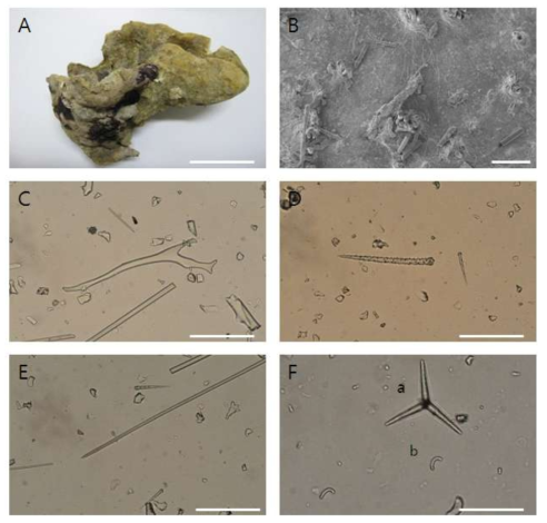 Micrscleroderma chujaensis n. sp. A, entire animal. B, surface. C, demas. D, acnanthostyles. E, oxea. F, metaster(a), sigmaster(b). Scale bars = 5 cm (A), 300 ㎛ (B); 30 ㎛ (C-F)