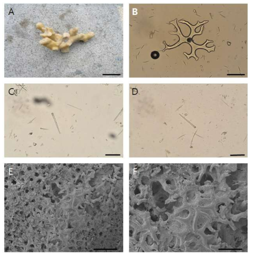 Discodermia kimyoungensis n. sp. A, entire animal. B, discotriane. C-D, acanthostyle. E-F, skeleton. Scale bars = 2 cm (A), 100 ㎛(B), 50 ㎛ (C-D), 500 ㎛ (E), 300 ㎛ (F)