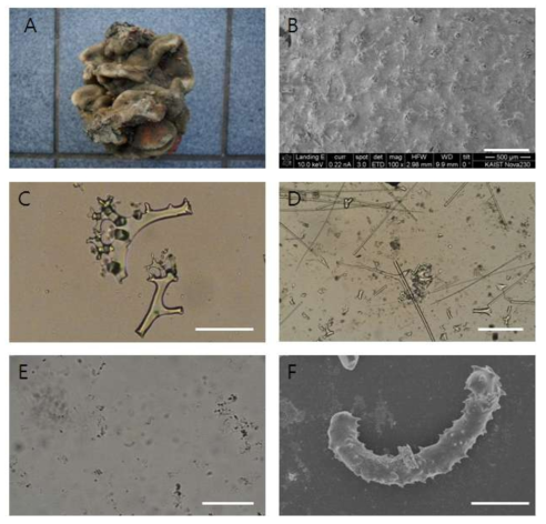 Microscleroderma hirsutum A, entire animal. B, surface. C, demas, D, oxeas. E, sigmasters. F, sigmaster. Scale bars = 2 cm (B), 500 ㎛; (C-D), 200 ㎛; (E), 40 ㎛; (F), 3 ㎛