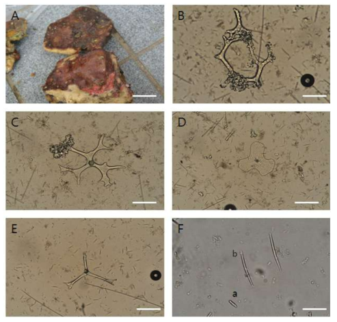 Discodermia discifera A, entire animal. B, desma. C, discotriaene. D, discotriaene. E, crepis. F, microstrongle(a), microxea(b). Scale bars = 3 cm (A), 300 ㎛ (B-E), 20 ㎛ (F)