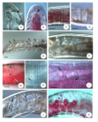 Micrographs of Achaeta multisacculata sp. n