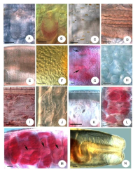 Micrographs of Fridericia flaviformis sp. n