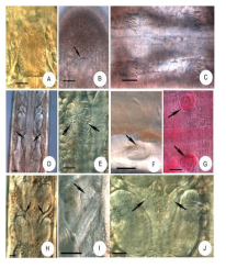 Micrographs of Bryodrilus deogyunensis sp. n