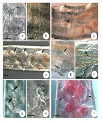 Micrographs of Chamaedrilus laponicus