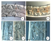 Micrographs of Chamaedrilus varisetosus