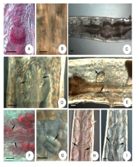 Micrographs of Bryodrilus diverticulatus