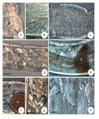 Micrographs of Marionina communis