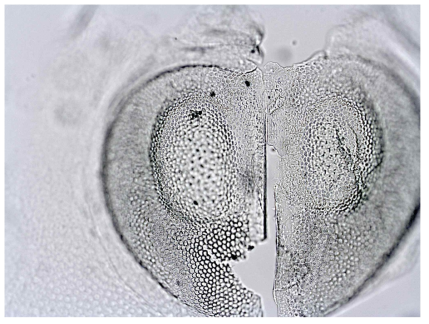 Opened ephippium