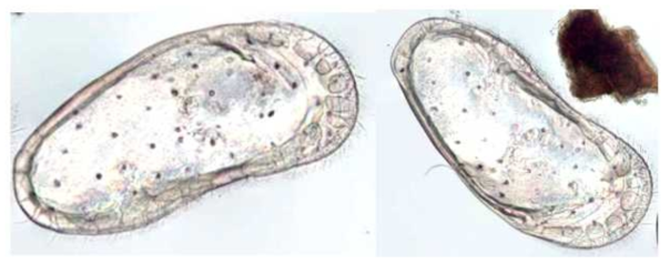 Callistocythere laevis microphotograph of the right and left valves