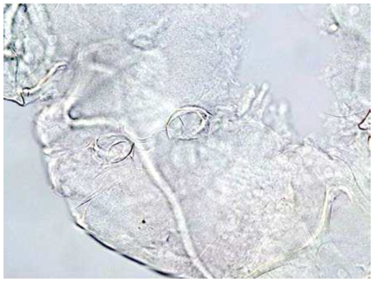 Pontocythere miurensis microphotographs of the female genital field