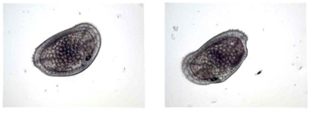 Aurila disarata microphotographs of the left and right valve