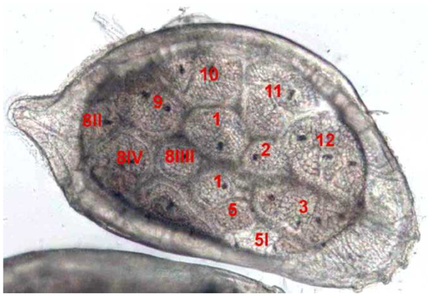 Hemicytherura okuboi microphotograph of the right valve with labelled fossae