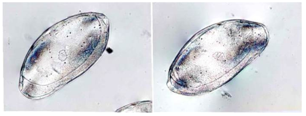 Obesostoma setosum microphotographs of the left and right valves