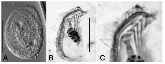 Photomicrographs of Pseudochilodonopsis mutabilis from life (A) and after protargol impregnation (B, C). (A) Arrows indicate contractile vacuoles. Scale bars = 20 μm.Photomicrographs of Pseudochilodonopsis mutabilis from life (A) and after protargol impregnation (B, C). (A) Arrows indicate contractile vacuoles. Scale bars = 20 μm