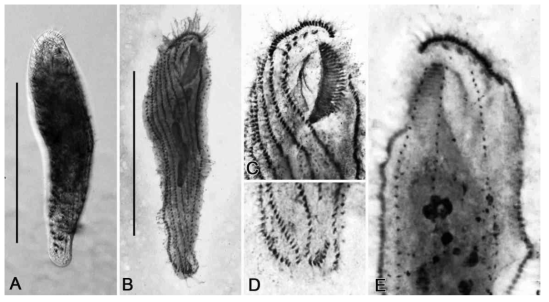 Photomicrographs of Parabirojimia similis from life (A) and after protargol impregnation (B-E). Scale bars = 100 μm