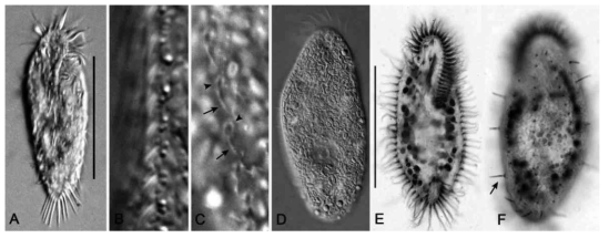 Photomicrographs of Arcuseries warreni from life (A-D) and after protargol impregnation (E, F). (C) Dorsal kineties (arrows) and cortical granules (arrowheads) in dorsal surface. (E) Arrow indicates ejected granule. Scale bars = 50 μm