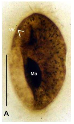 Photomicrographs of Frontonia canadensis based on protargol impregnation. A, ventral view of protargol impregnated specimen. Scale bar: 50 μm