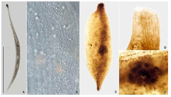 Tracheloraphis dracontoides in vivo (A, B) and after protargol impregnation (C–E). Scale bars = 500 μm (A); 30 μm (B)