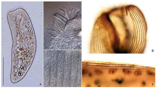 Condylostoma arenarium in vivo (A–C) and after protargol impregnation (D, E). Scale bars = 200 μm (A); 10 μm (C)