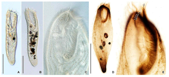 Condylostoma vorax in vivo (A–C) and after protargol impregnation (D, E). Scale bars = 100 μm (A, B, D)