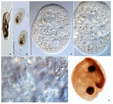 Peritromus kahli in vivo (A–E) and after protargol impregnation (F). Scale bars = 100 μm (B); 50 μm (C); 30 μm (E)