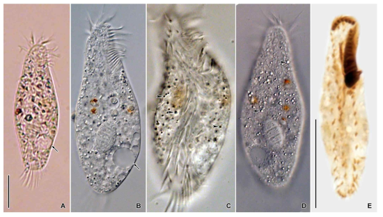 Holosticha pullaster in vivo (A–D) and protargol impregnated specimen (E). Scale bars = 20 μm