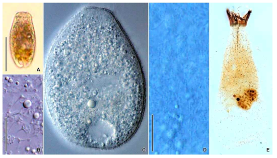 Enchelys gasterosteus in vivo (A–D) and after protargol impregnation (E). Scale bars = 50 μm (A); 10 μm (B, D)