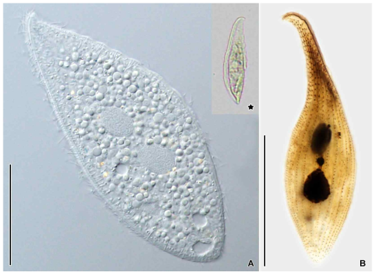 Loxophyllum helus in vivo (A) and after protargol impregnation (B). Asterisk indicates original body shape on low magnification. Scale bars = 50 μm