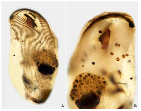 Aegyria oliva after protargol impregnation (A). Scale bar = 50 μm