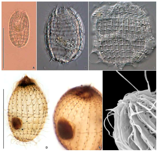 Pinacocoleps tesselatus in vivo (A–C), after protargol impregnation (D, E) and scanning electron microscope (F). Scale bars = 50 μm (A), 30 μm (D)