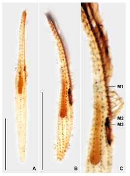 Cohnilembus verminus after protargol impregnation. Scale bars = 30 μm