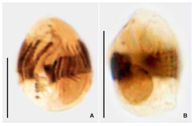 Urozona buetschlii after protargol impregnation (A, B). Scale bars = 10 μm