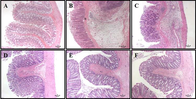 DSS로 유도된 대장염 모델에서 식의약 소재인 HPL-01이 대장 조직에 미치는 영향 A : Normal, B : Control, C : HPL 50, D : HPL 100, E : HPL 200, F : SUL 100. ×40. Scale bar = 100 μm