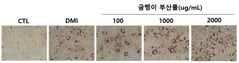 굼벵이 부산물의 지방구 생성 억제 확인(Oil Red O stain)