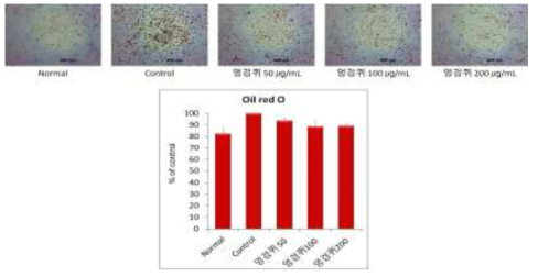 3T3-L1 지방세포에서 엉겅퀴 추출물의 지방구 억제 효과
