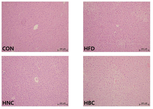 고지방식이를 섭취 한 C57BL / 6 마우스에서 조직 학적 비 알코올성 지방 간염에 미치는 영향 H 일반식이 + 증류수, HFD; 고지방식이 (45%) + 증류수, HNC_ob; 고지방식이 (45%) +나물, HBC_ob; 고지방식이 (45%) +비빔밥