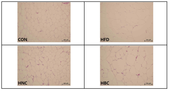 고지방식이로 유도 된 C57BL/6 마우스 비만 모델에서 후복막 지방 세포 크기에 대한 비빔밥의 효과. CON; 일반식이 + 증류수, HFD; 고지방식이 (45%) +증류수, HNC_ob; 고지방식이 (45%) +나물, HBC_ob; 고지방식이 (45%) +비빔밥