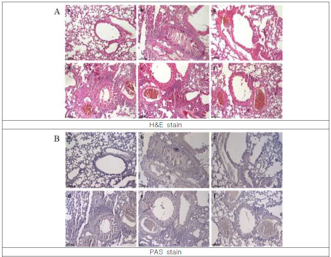 폐 조직을 이용한 조직병리학적 분석. A, H B, PAS stain a, CON; b, OVA; c, DEX; d, 진생베리 750 mg/kg; e, 진생베리 1500 mg/kg; f, 진생베리 3000 mg/kg; scale bar 100 μm, x400