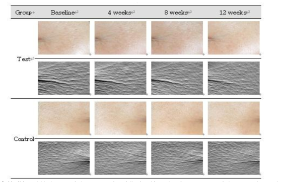 Skin wrinkle images of the crow’s feet following 12 weeks after treatment of the test and control products (Upper: standard optical image, lower: replica image, Subject #29 (Test group), #11 (Control group))