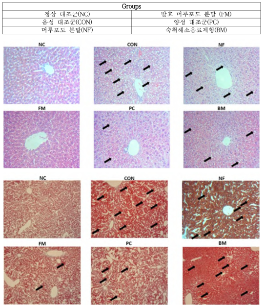 상: H&E Stain (x200), 하: Oil red O Stain (x200)