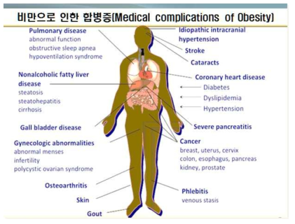 비만으로 인한 합병증(출처 : 2015년 국제보건기구(WHO)
