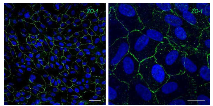 Immunocytochemistry 통한 RPE의 morphology 확인